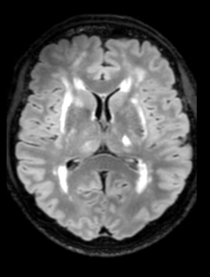 brain_mri