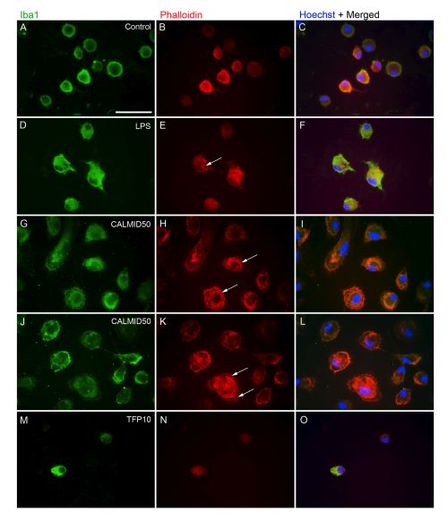 neuroinflam1